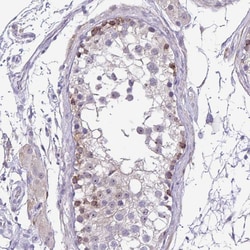Invitrogen DCAMKL2 Polyclonal Antibody 100 &mu;L; Unconjugated:Antibodies,