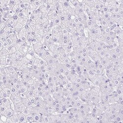 Invitrogen DCAMKL2 Polyclonal Antibody 100 &mu;L | Buy Online | Invitrogen&trade; | Fisher Scientific