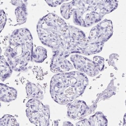 Invitrogen Defensin 5 Polyclonal Antibody 100 &mu;L; Unconjugated:Antibodies,