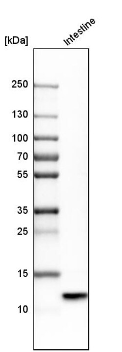 Invitrogen Defensin 5 Polyclonal Antibody 100 &mu;L; Unconjugated:Antibodies,