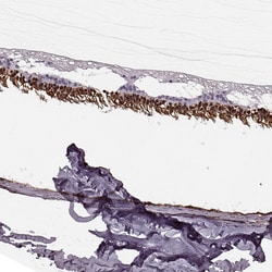 Invitrogen Recoverin Polyclonal Antibody 100 &mu;L; Unconjugated:Antibodies,