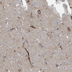 Invitrogen PTPRE Polyclonal Antibody 100 &mu;L; Unconjugated:Antibodies,