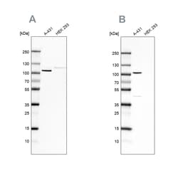 Invitrogen delta Catenin Polyclonal Antibody 100 &mu;L; Unconjugated:Antibodies,