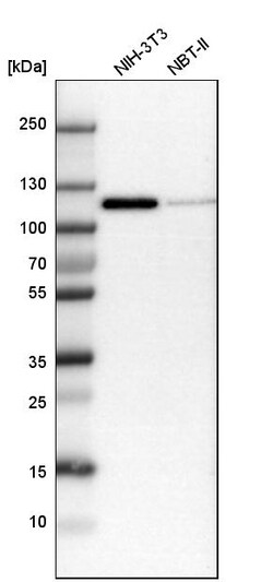 Invitrogen delta Catenin Polyclonal Antibody 100 &mu;L; Unconjugated:Antibodies,