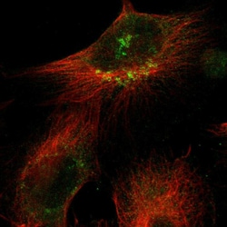 Invitrogen SIK2 Polyclonal Antibody 100 &mu;L; Unconjugated:Antibodies,