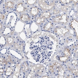 Invitrogen DARC Polyclonal Antibody 100 &mu;L; Unconjugated:Antibodies,
