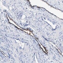 Invitrogen DARC Polyclonal Antibody 100 &mu;L; Unconjugated:Antibodies,