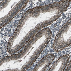 Invitrogen HRI Polyclonal Antibody 100 &mu;L; Unconjugated:Antibodies,
