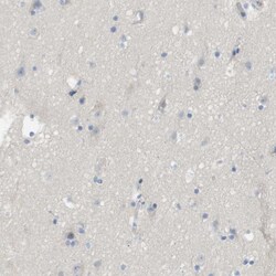 Invitrogen MYL3 Polyclonal Antibody 100 &mu;L; Unconjugated:Antibodies,