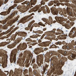 Invitrogen MYL3 Polyclonal Antibody 100 &mu;L; Unconjugated:Antibodies,