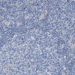 Invitrogen MYL3 Polyclonal Antibody 100 &mu;L; Unconjugated:Antibodies,