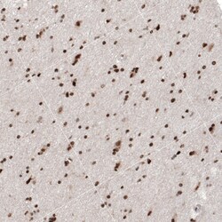 Invitrogen HP1 alpha Polyclonal Antibody 100 &mu;L; Unconjugated:Antibodies,