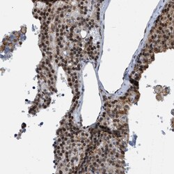 Invitrogen HP1 alpha Polyclonal Antibody 100 &mu;L; Unconjugated:Antibodies,