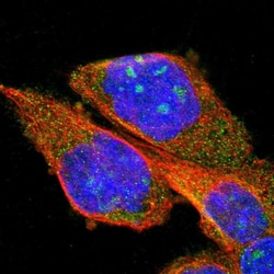 Invitrogen PPM1B Polyclonal Antibody 100 &mu;L; Unconjugated:Antibodies,