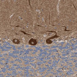 Invitrogen PPM1B Polyclonal Antibody 100 &mu;L; Unconjugated:Antibodies,