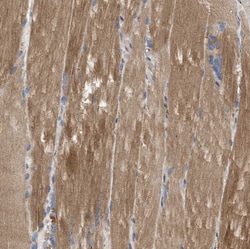 Invitrogen PPM1B Polyclonal Antibody 100 &mu;L; Unconjugated:Antibodies,