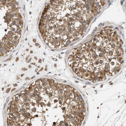 Invitrogen PPM1B Polyclonal Antibody 100 &mu;L; Unconjugated:Antibodies,