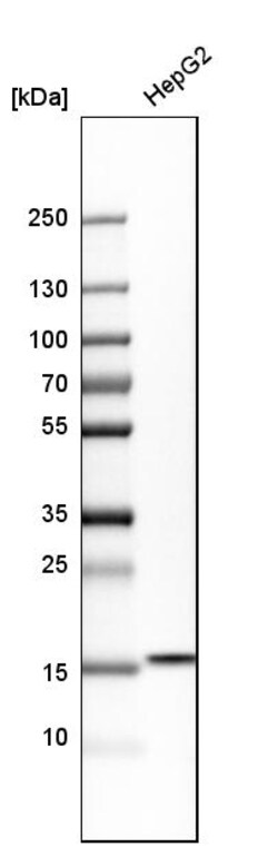 Invitrogen Acid Phosphatase 1 Polyclonal Antibody 100 &mu;L; Unconjugated:Antibodies,
