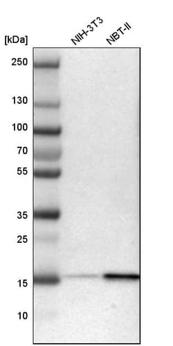 Invitrogen Acid Phosphatase 1 Polyclonal Antibody 100 &mu;L; Unconjugated:Antibodies,