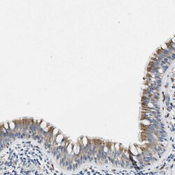 Invitrogen ZDHHC13 Polyclonal Antibody 100 &mu;L; Unconjugated:Antibodies,