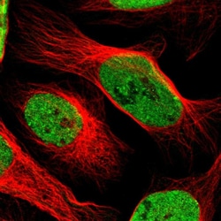 Invitrogen SAFB Polyclonal Antibody 100 &mu;L; Unconjugated:Antibodies,