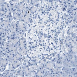 Invitrogen CD46 Polyclonal Antibody 100 &mu;L | Buy Online | Invitrogen&trade; | Fisher Scientific
