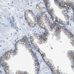 Invitrogen CD46 Polyclonal Antibody 100 &mu;L | Buy Online | Invitrogen&trade; | Fisher Scientific