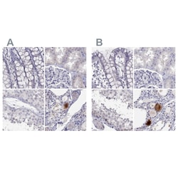 Invitrogen C16orf89 Polyclonal Antibody 100 &mu;L | Buy Online | Invitrogen&trade; | Fisher Scientific