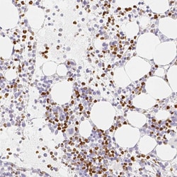 Invitrogen PADI4 Polyclonal Antibody 100 &mu;L; Unconjugated:Anticuerpos