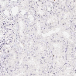 Invitrogen PADI4 Polyclonal Antibody 100 &mu;L; Unconjugated:Anticuerpos