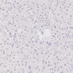 Invitrogen PADI4 Polyclonal Antibody 100 &mu;L; Unconjugated:Anticuerpos
