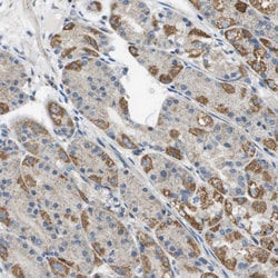 Invitrogen JIK Polyclonal Antibody 100 &mu;L; Unconjugated:Antibodies,