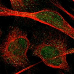 Invitrogen PIP5K1C Polyclonal Antibody 100 &mu;L; Unconjugated:Antibodies,