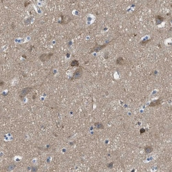 Invitrogen PIP5K1C Polyclonal Antibody 100 &mu;L; Unconjugated:Antibodies,