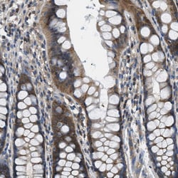 Invitrogen PIP5K1C Polyclonal Antibody 100 &mu;L; Unconjugated:Antibodies,