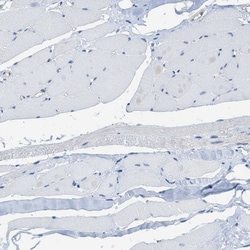Invitrogen PIP5K1C Polyclonal Antibody 100 &mu;L; Unconjugated:Antibodies,