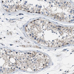 Invitrogen PIP5K1C Polyclonal Antibody 100 &mu;L; Unconjugated:Antibodies,