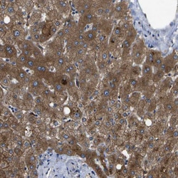 Invitrogen HFE Polyclonal Antibody 100 &mu;L; Unconjugated:Antibodies,