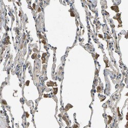 Invitrogen HFE Polyclonal Antibody 100 &mu;L; Unconjugated:Antibodies,