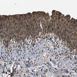 Invitrogen HFE Polyclonal Antibody 100 &mu;L; Unconjugated:Antibodies,