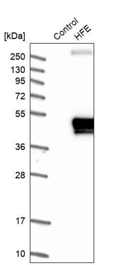 Invitrogen HFE Polyclonal Antibody 100 &mu;L; Unconjugated:Antibodies,