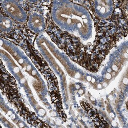 Invitrogen Caldesmon Polyclonal Antibody 100 &mu;L; Unconjugated:Antibodies,