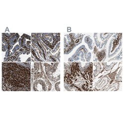 Invitrogen Caldesmon Polyclonal Antibody 100 &mu;L; Unconjugated:Antibodies,