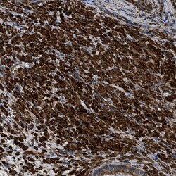 Invitrogen Caldesmon Polyclonal Antibody 100 &mu;L; Unconjugated:Antibodies,