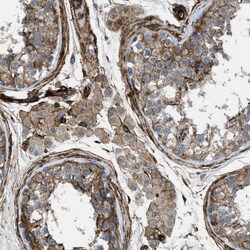 Invitrogen Caldesmon Polyclonal Antibody 100 &mu;L; Unconjugated:Antibodies,