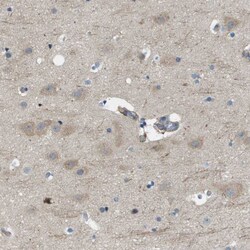 Invitrogen OTUD5 Polyclonal Antibody 100 &mu;L; Unconjugated:Antibodies,