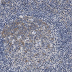 Invitrogen OTUD5 Polyclonal Antibody 100 &mu;L; Unconjugated:Antibodies,