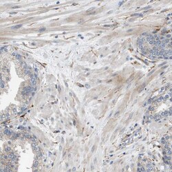 Invitrogen OTUD5 Polyclonal Antibody 100 &mu;L; Unconjugated:Antibodies,