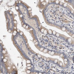 Invitrogen MGAT1 Polyclonal Antibody 100 &mu;L; Unconjugated:Antibodies,
