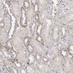 Invitrogen MGAT1 Polyclonal Antibody 100 &mu;L; Unconjugated:Antibodies,